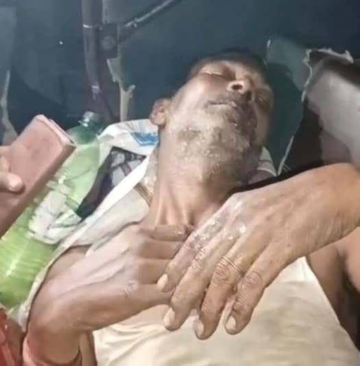 फ्री में जलेबी न देने पर दबंगो ने खोलता हुआ तेल दुकानदार पर उड़ेला